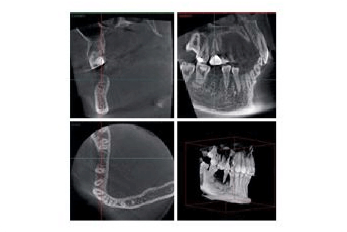 多様な臨床を支える3Dイメージング