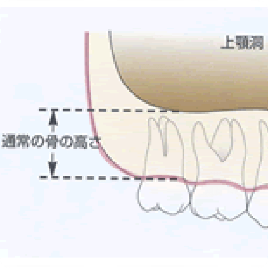 難症例