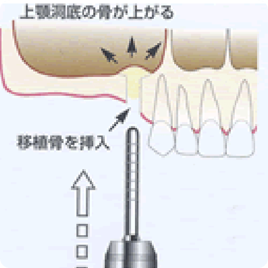 難症例