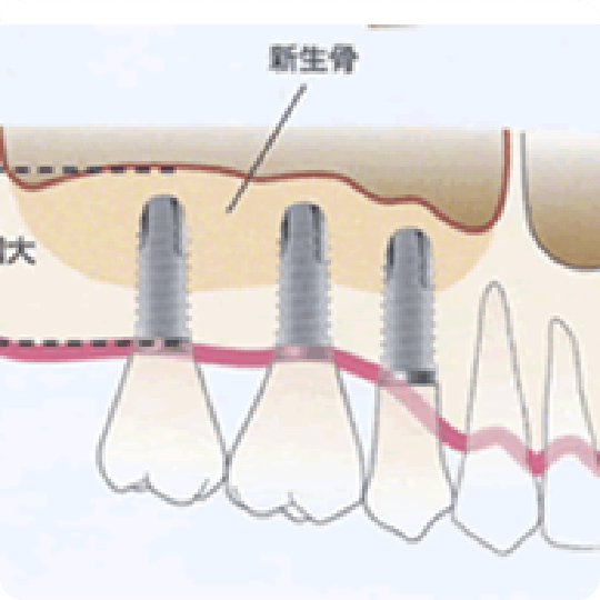 難症例